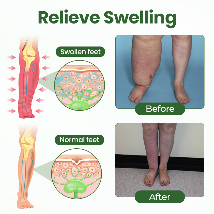 Cvreoz® BodyRelief Circulation Cream — 48-Hour Visible Swelling Relief
