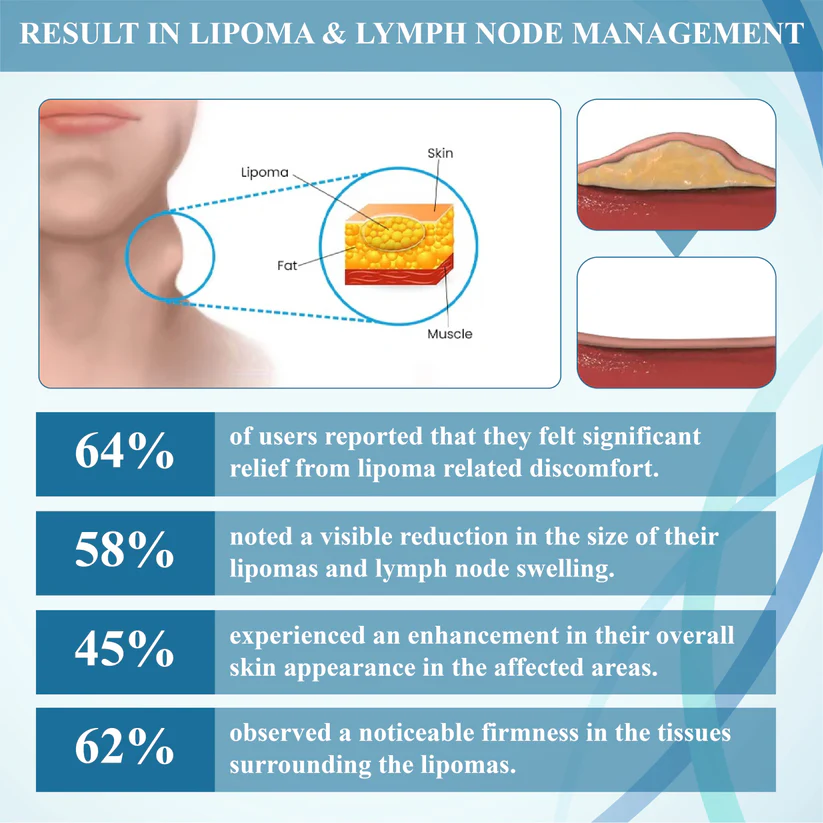 LIMITED TIME SALE OFF 60%đ„ CvreozÂź LumpsClear Lymph Support Roll-On