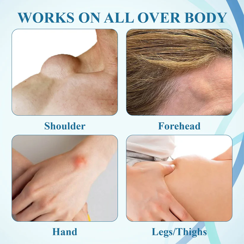 LIMITED TIME SALE OFF 60%đ„ CvreozÂź LumpsClear Lymph Support Roll-On