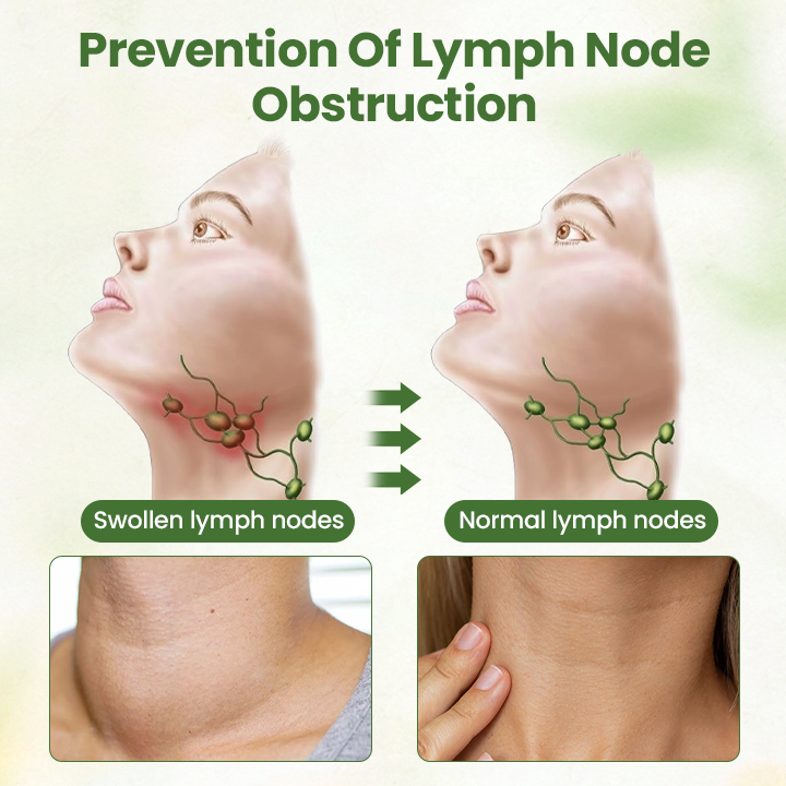 ⏰Last Day Promotion: 60% OFF🔥 Cvreoz® Lymphatic Detox Herbal Cream