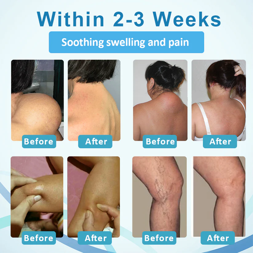 LIMITED TIME SALE OFF 60%đ„ CvreozÂź LumpsClear Lymph Support Roll-On