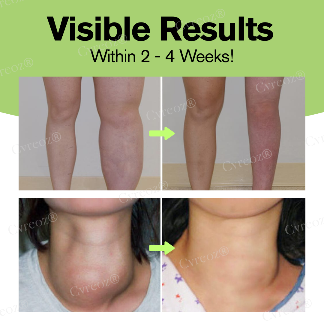 ⏰Last Day Promotion: 60% OFF🔥Cvreoz® Herbal Lymphatic Detox Cream