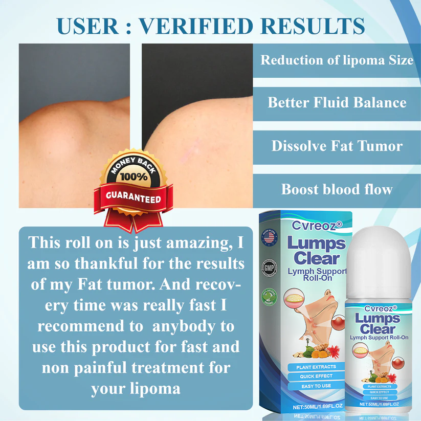 LIMITED TIME SALE OFF 60%đ„ CvreozÂź LumpsClear Lymph Support Roll-On