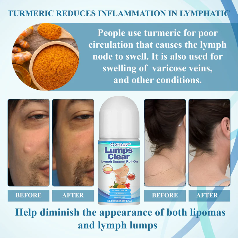 LIMITED TIME SALE OFF 60%đ„ CvreozÂź LumpsClear Lymph Support Roll-On