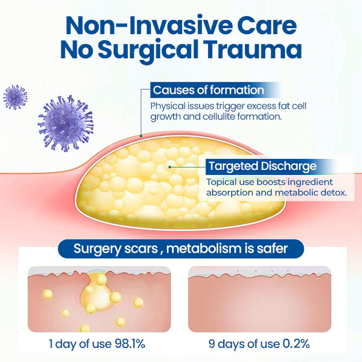 ⏰Last Day Promotion: 60% OFF🔥 Cvreoz® Lipoma Removal Cream