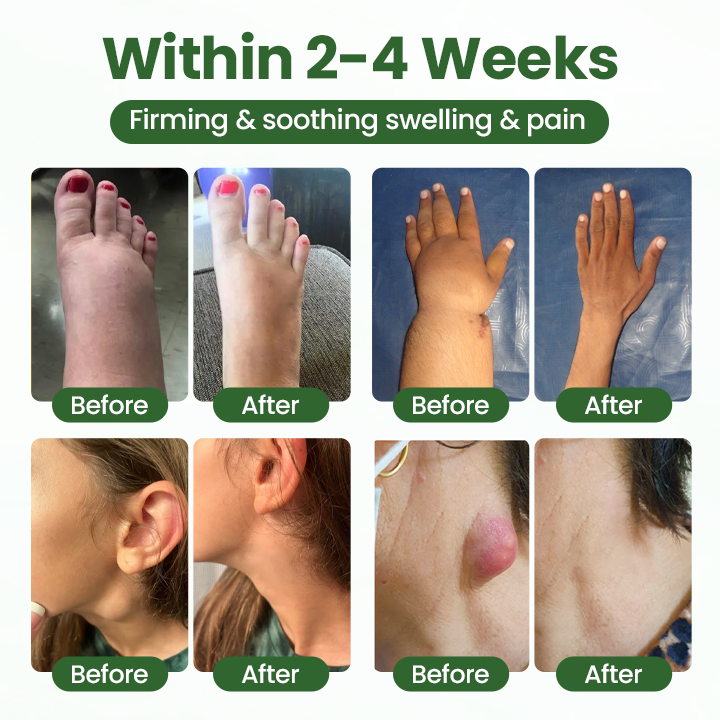 Cvreoz® BodyRelief Circulation Cream — 48-Hour Visible Swelling Relief