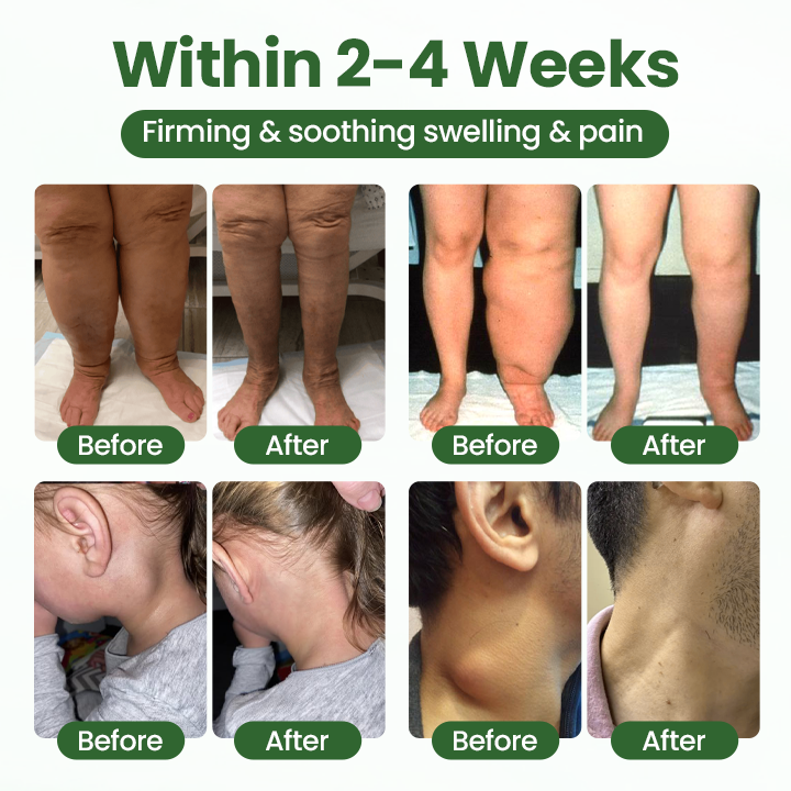Cvreoz® BodyRelief Circulation Cream — 48-Hour Visible Swelling Relief