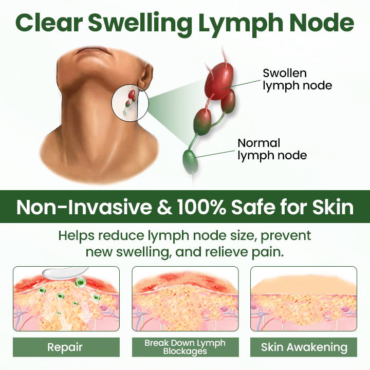 Cvreoz® BodyRelief Circulation Cream — 48-Hour Visible Swelling Relief