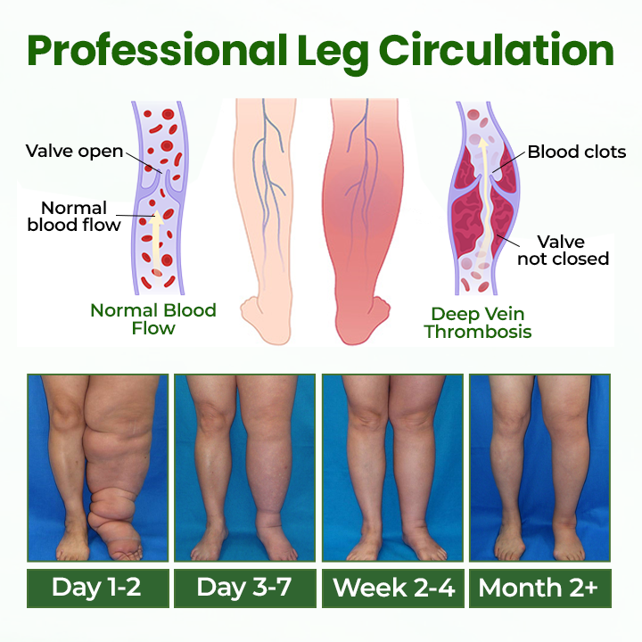 Cvreoz® BodyRelief Circulation Cream — 48-Hour Visible Swelling Relief