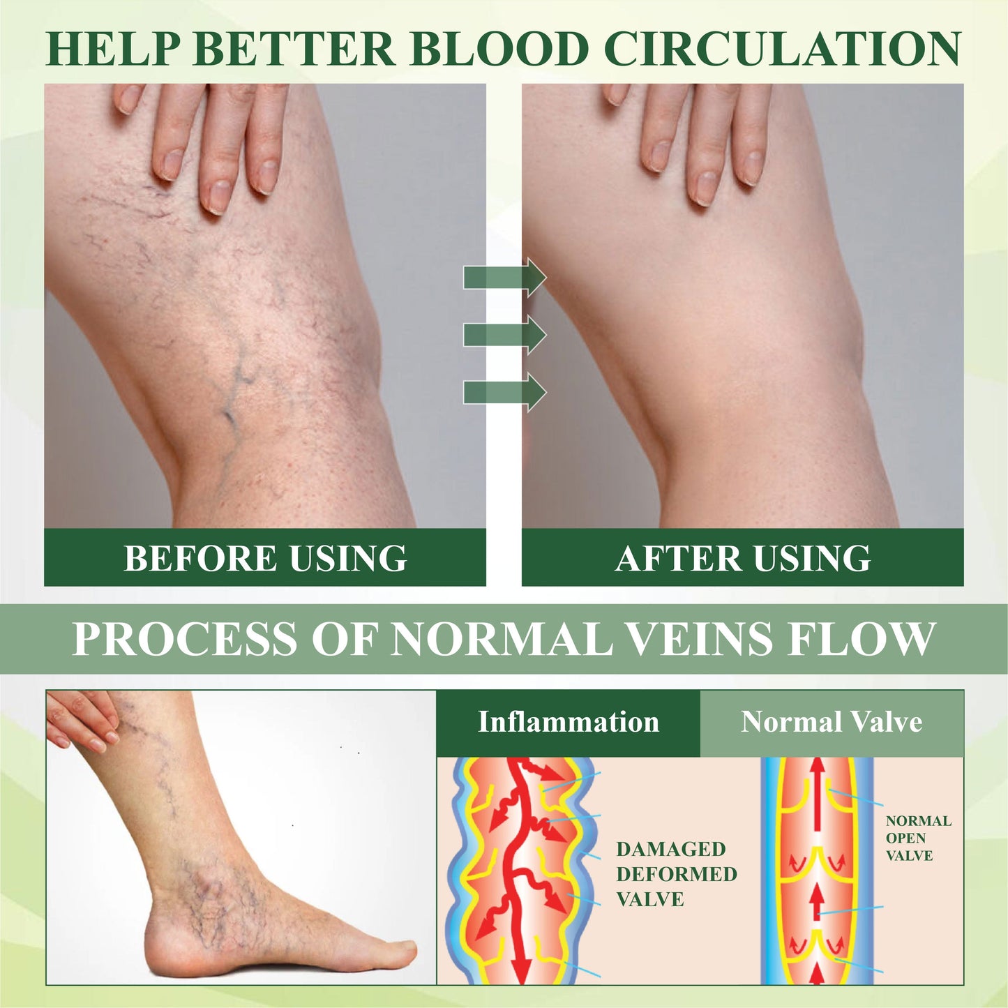 Cvreoz® FlowEase Leg Therapy Edema Cream