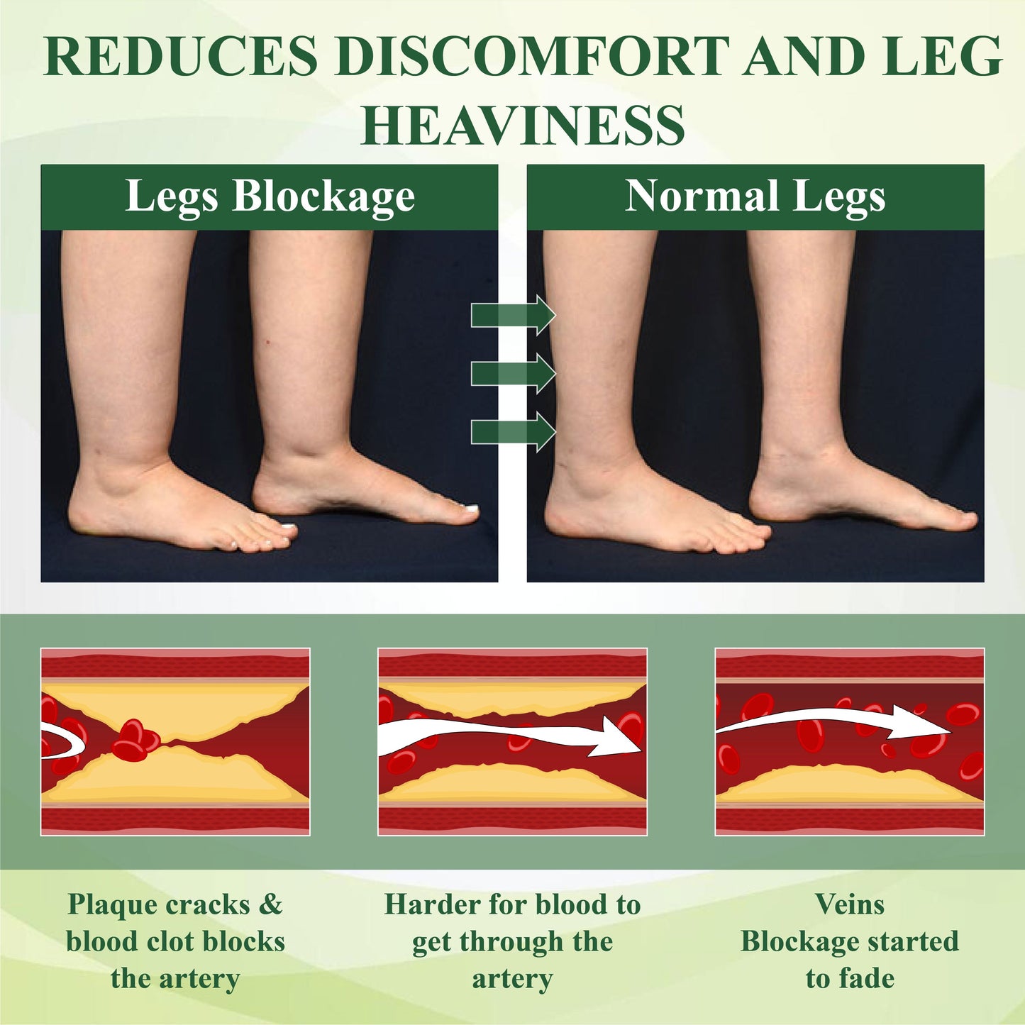 Cvreoz® FlowEase Leg Therapy Edema Cream