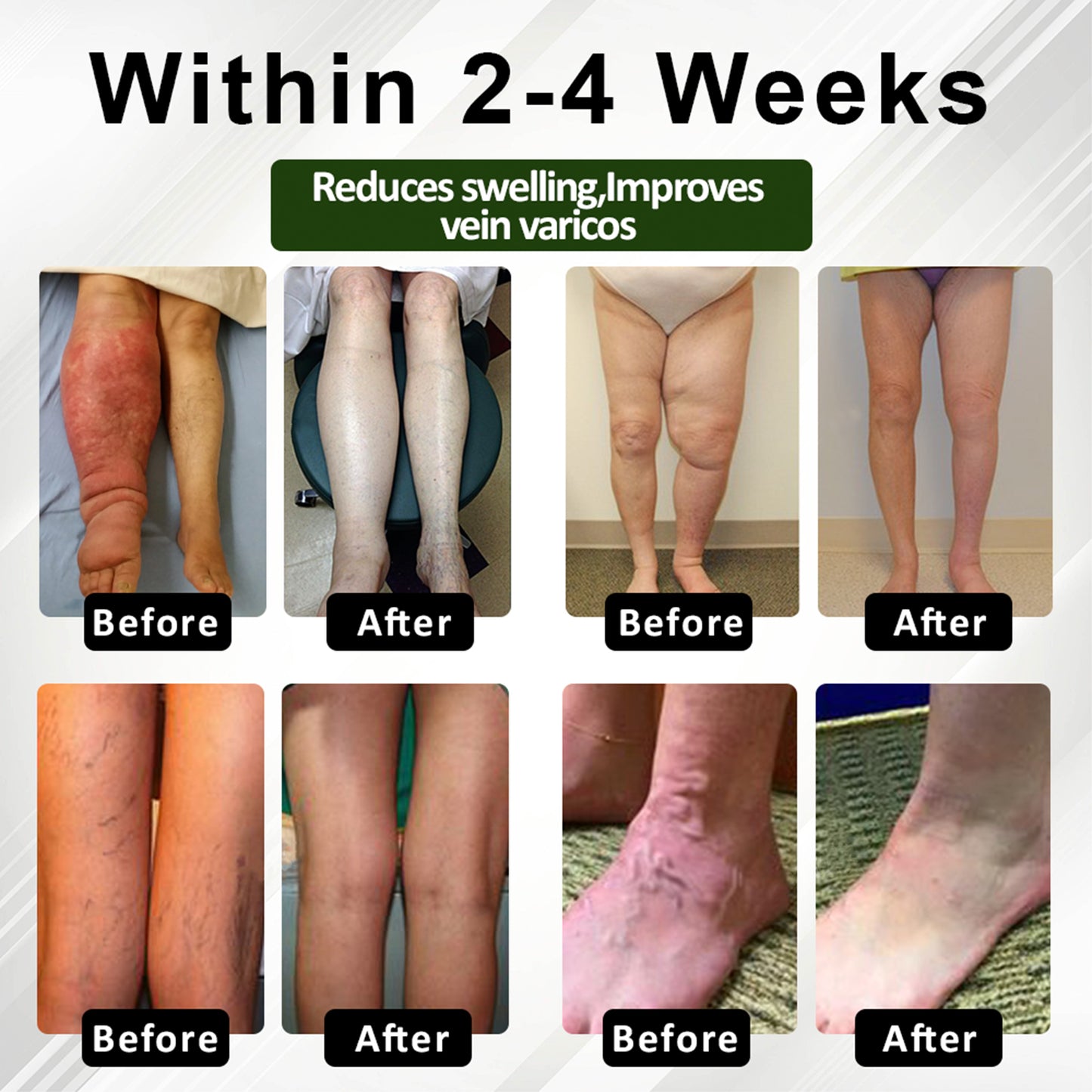 Cvreoz® FlowEase Leg Therapy Edema Cream