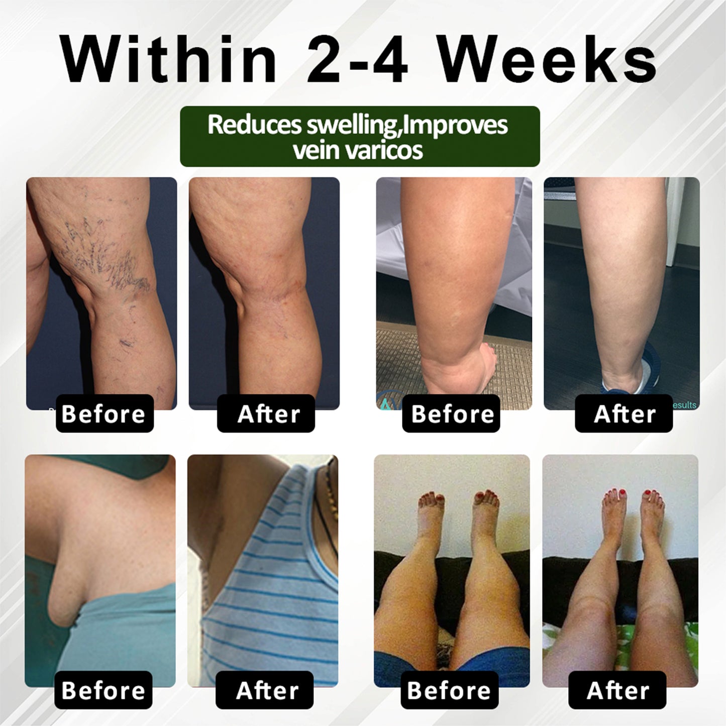 Cvreoz® FlowEase Leg Therapy Edema Cream