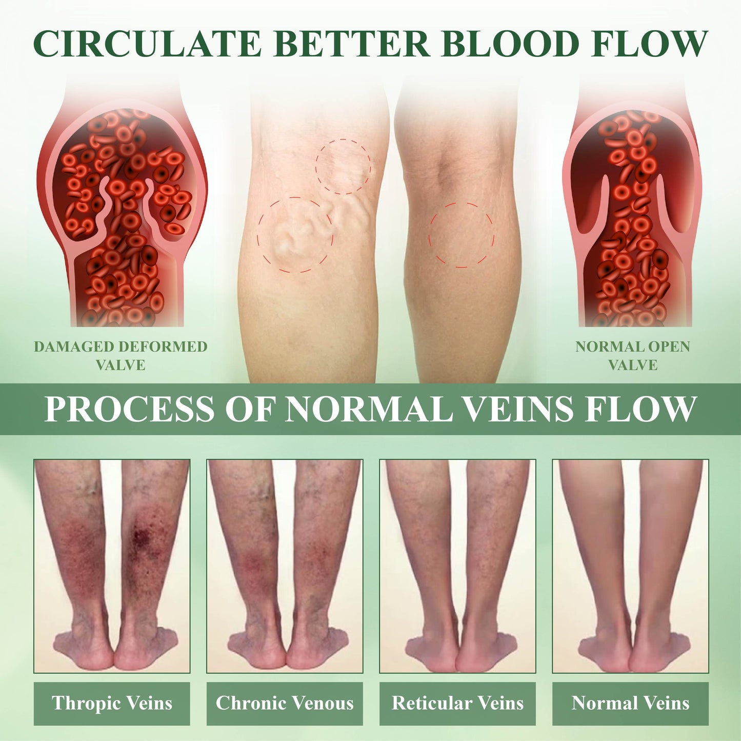 Cvreoz® FlowEase Leg Therapy Edema Cream