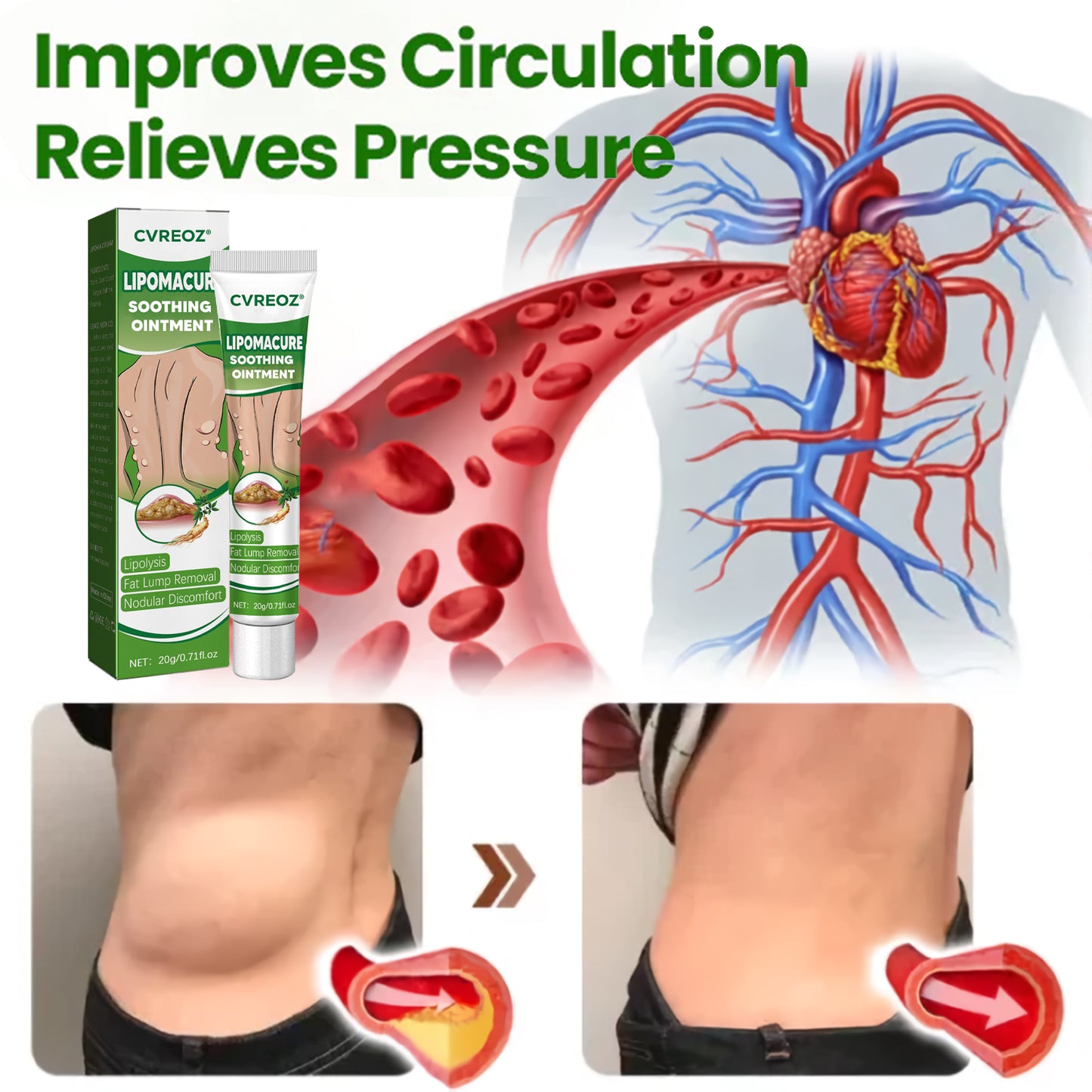 🔥Last Day Promotion: 60% OFF🔥 Cvreoz® LipomaCure Soothing Ointment