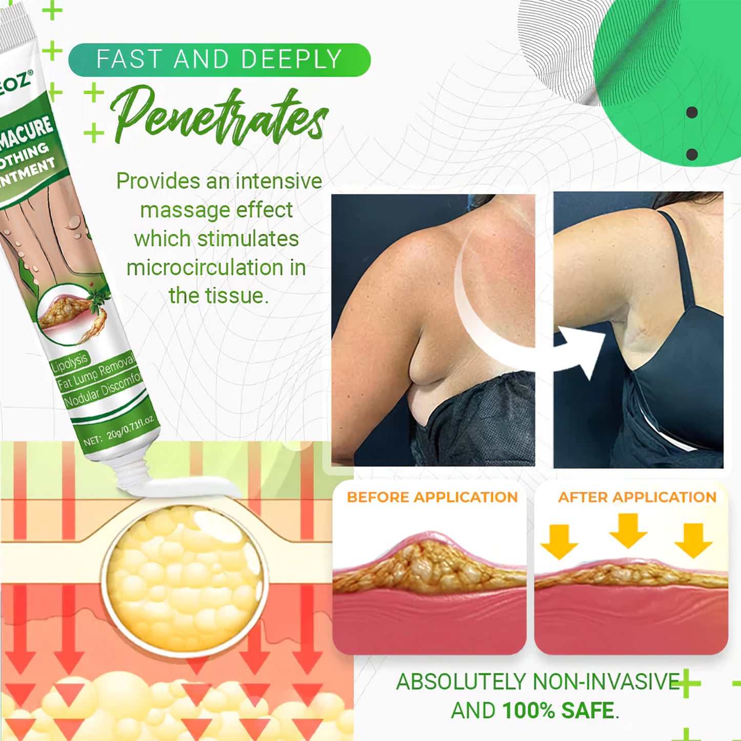 🔥Last Day Promotion: 60% OFF🔥 Cvreoz® LipomaCure Soothing Ointment