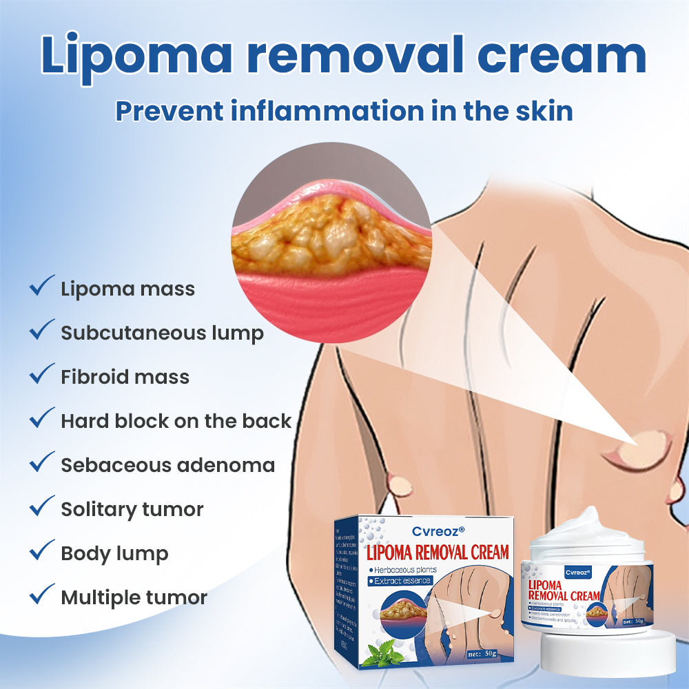 ⏰Last Day Promotion: 60% OFF🔥 Cvreoz® Lipoma Removal Cream