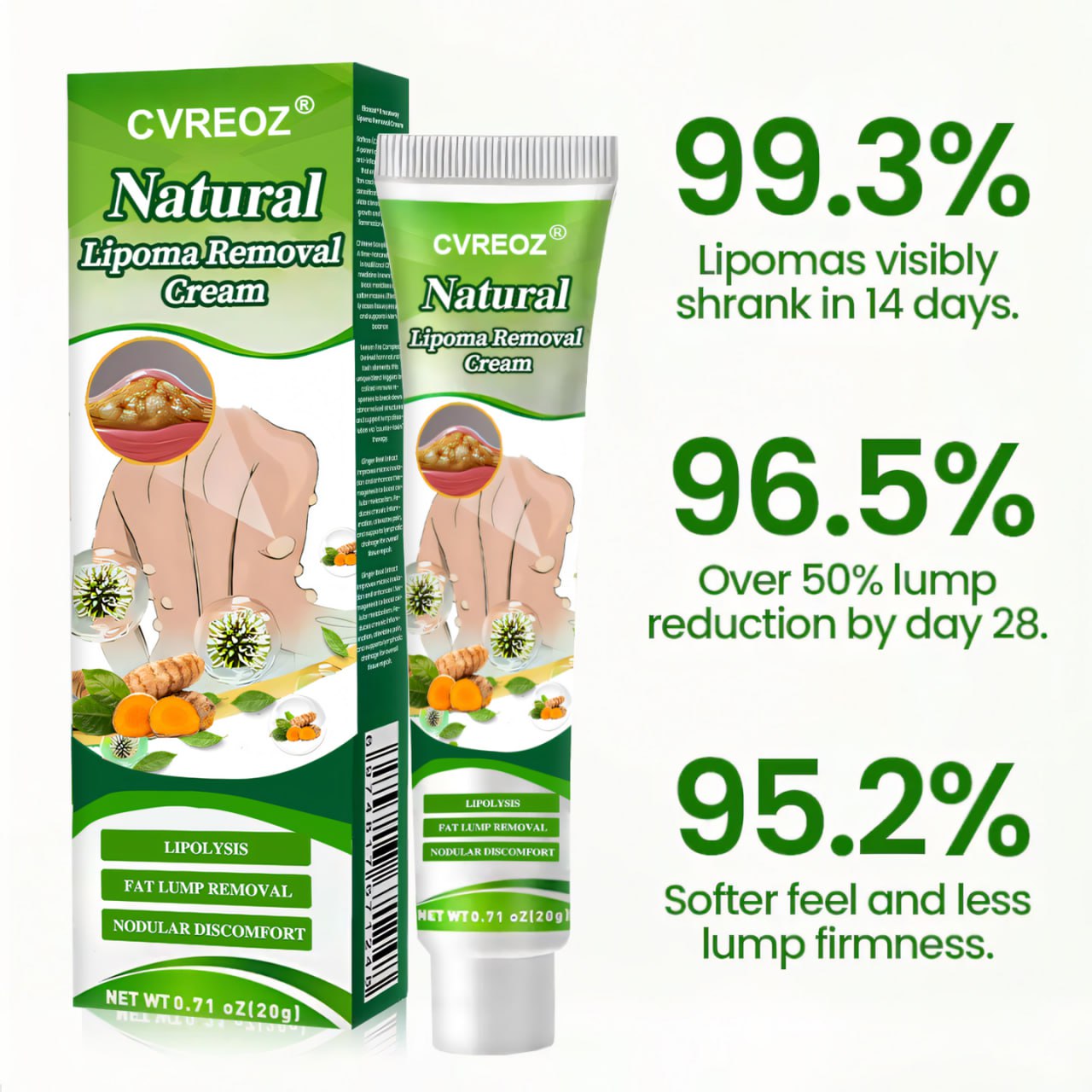 đ„ Limited Deal - 60% OFF! đ„ CvreozÂź Natural Lipoma Removal Cream
