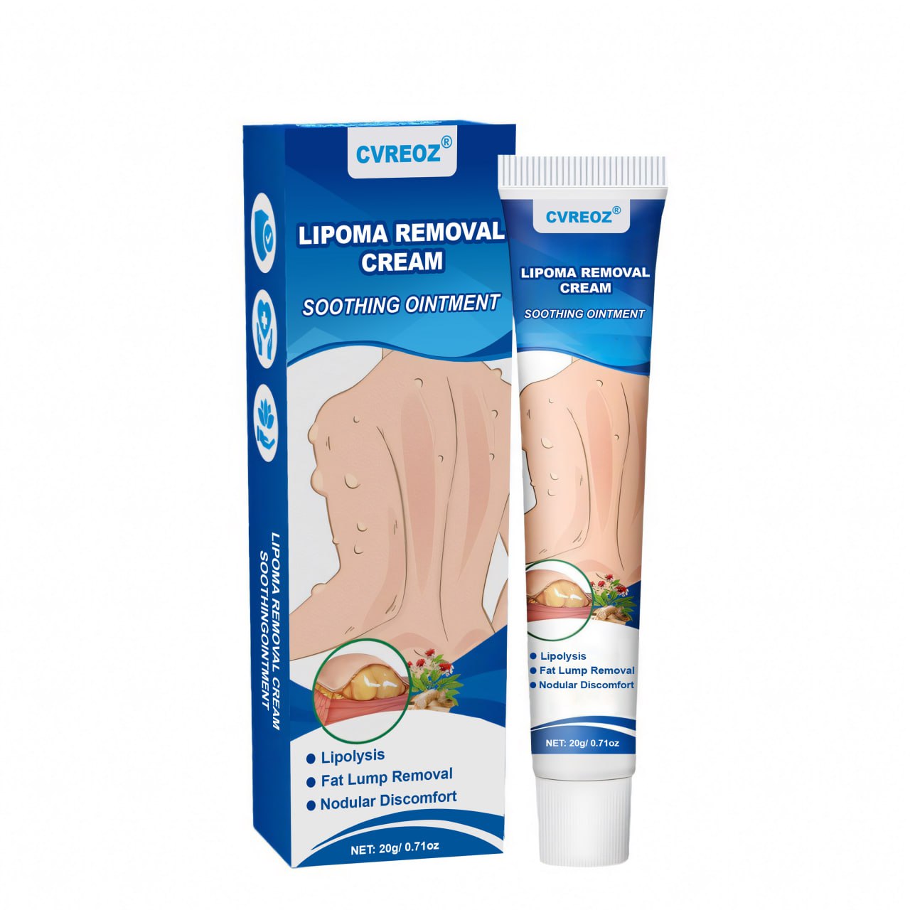 ⏰Last Day Promotion: 60% OFF🔥 Cvreoz® Lipoma Removal Cream