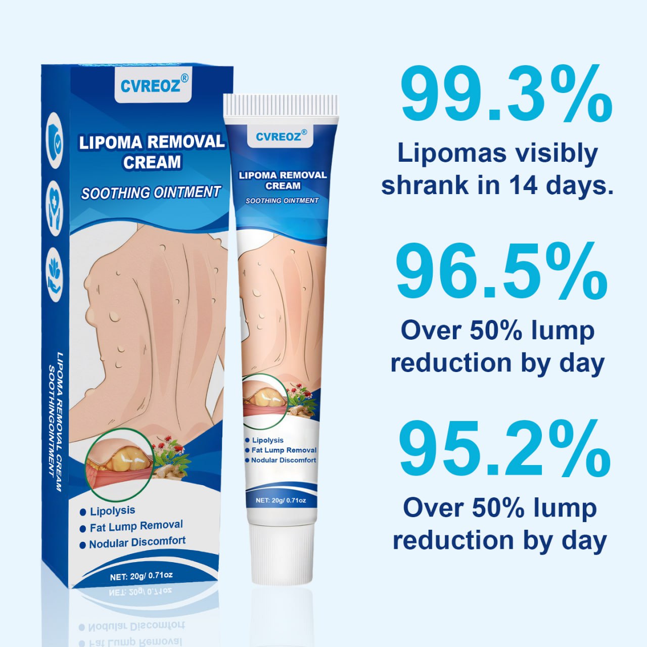 ⏰Last Day Promotion: 60% OFF🔥 Cvreoz® Lipoma Removal Cream