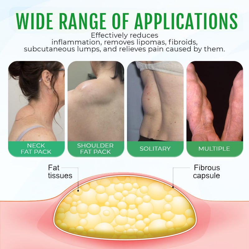 ⏰Last Day Promotion: 60% OFF🔥Cvreoz® DermaLump Relief Spray