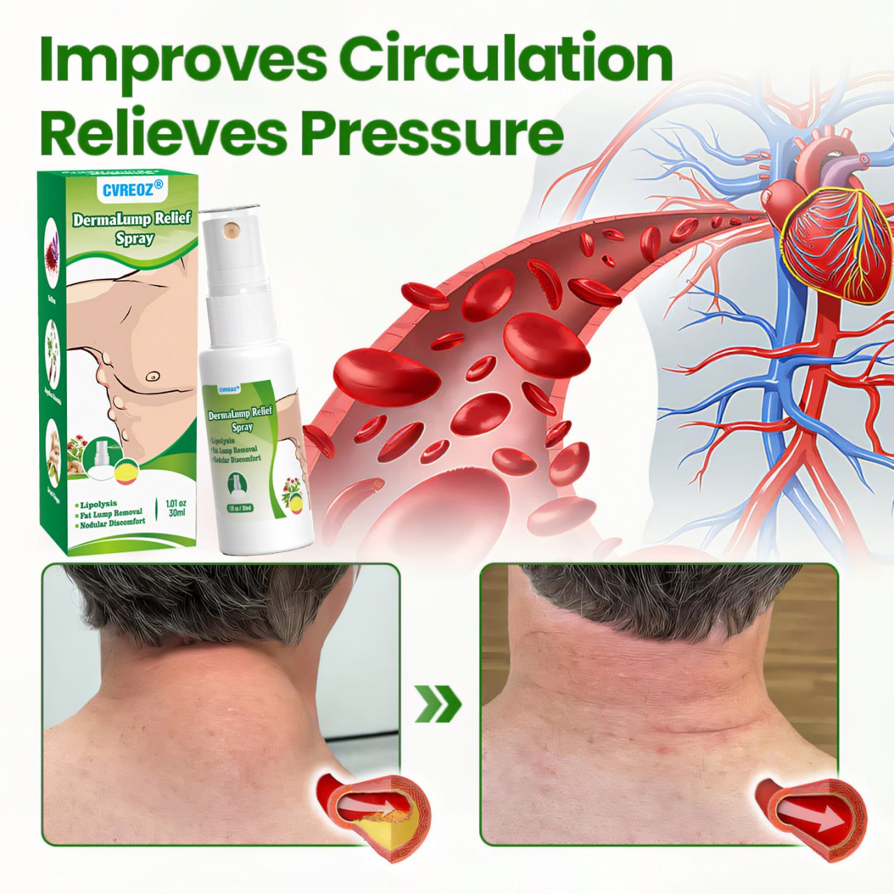 ⏰Last Day Promotion: 60% OFF🔥Cvreoz® DermaLump Relief Spray