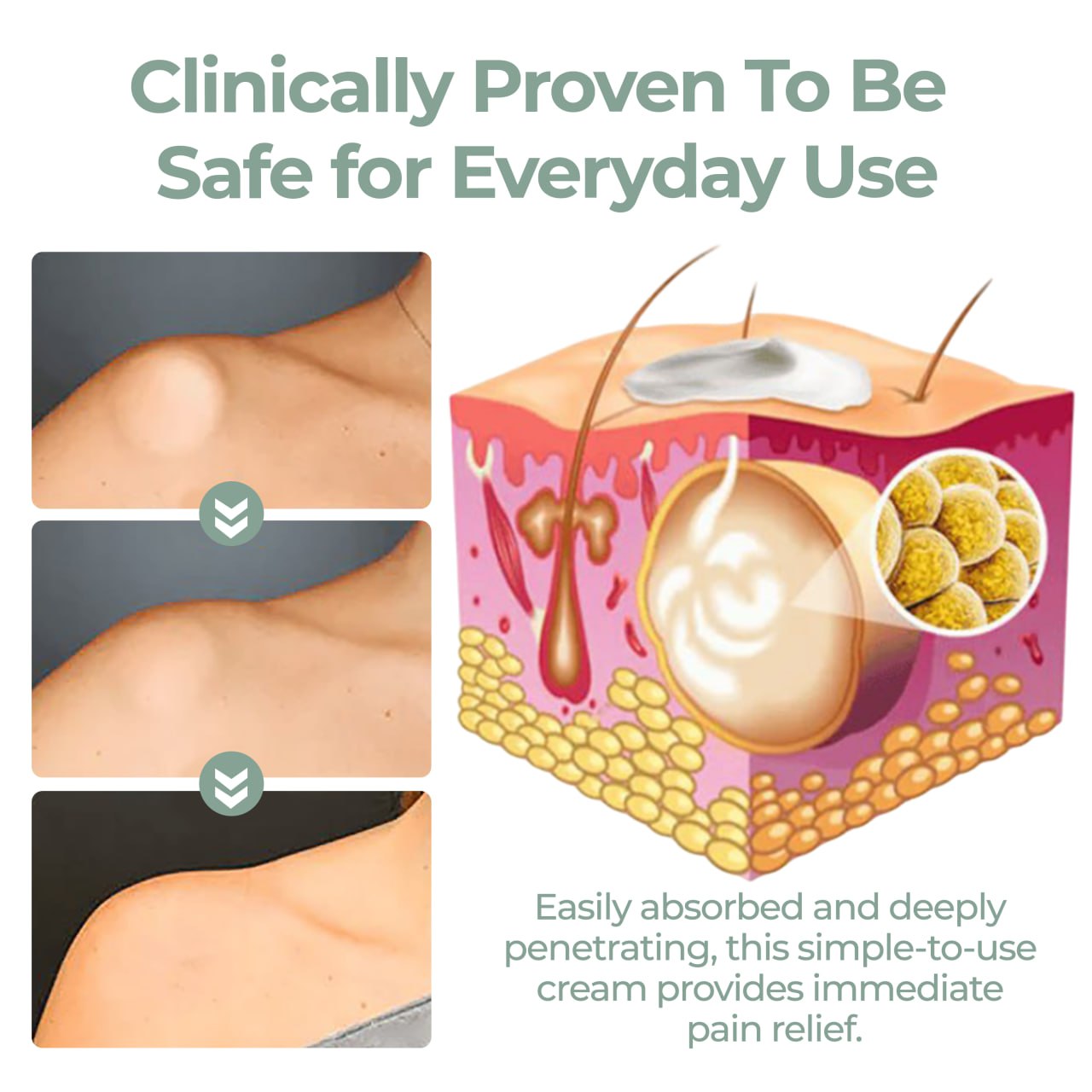 ⏰Last Day Promotion: 60% OFF🔥 Cvreoz® Lipoma Herbal Relief Cream