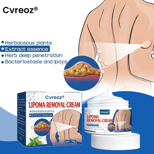 ⏰Last Day Promotion: 60% OFF🔥 Cvreoz® Lipoma Removal Cream