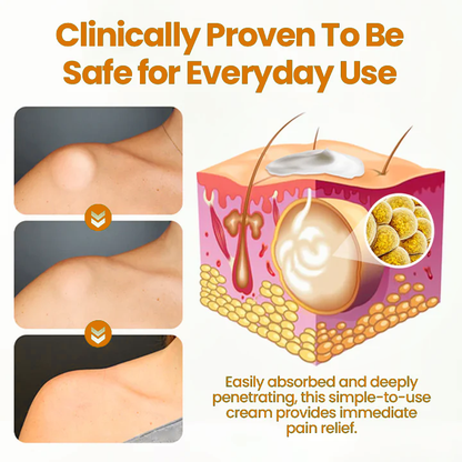 🔥 Sale up to 60% - Order NOW! 🔥 Cvreoz® Bee Venom  Lipoma Removal Cream