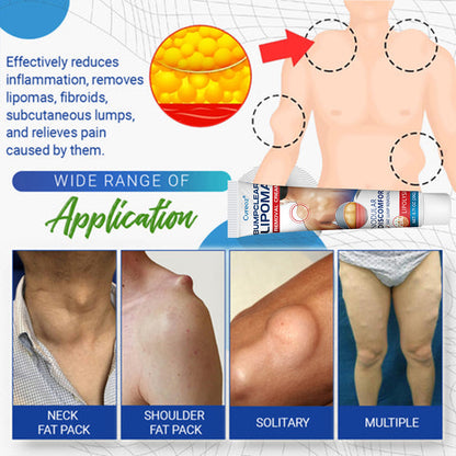 Cvreoz® BumpClear Lipoma Removal Cream