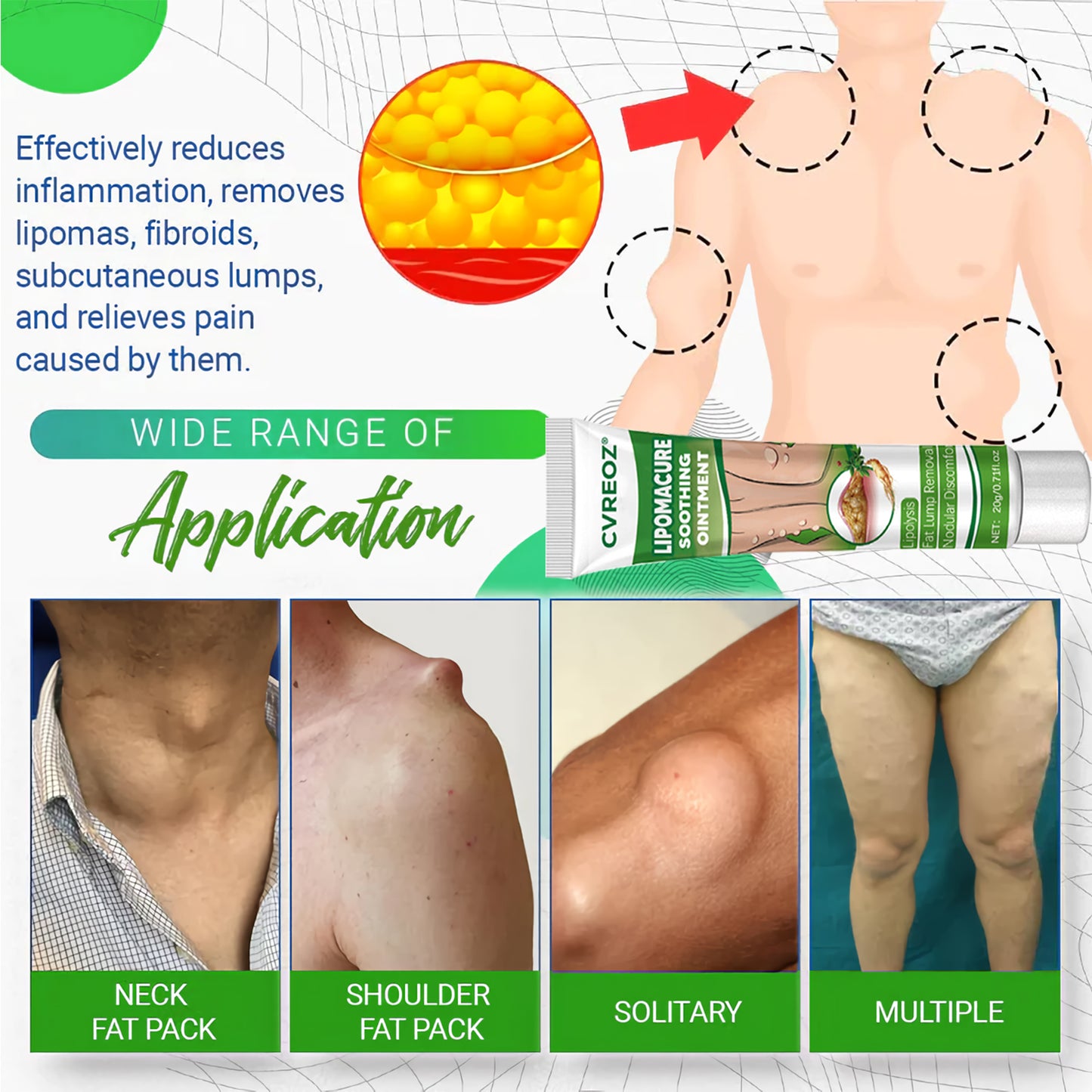🔥Last Day Promotion: 60% OFF🔥 Cvreoz® LipomaCure Soothing Ointment