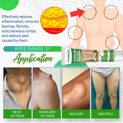 🔥Last Day Promotion: 60% OFF🔥 Cvreoz® LipomaCure Soothing Ointment