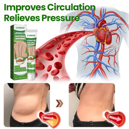 🔥Last Day Promotion: 60% OFF🔥 Cvreoz® LipomaCure Soothing Ointment