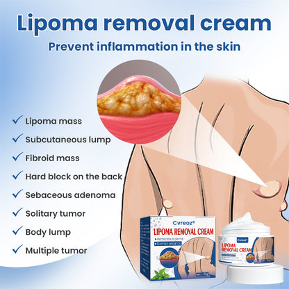 ⏰Last Day Promotion: 60% OFF🔥 Cvreoz® Lipoma Removal Cream