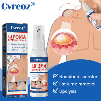 ⏰Last Day Promotion: 60% OFF🔥 Cvreoz® BumpGone Lipoma Treatment Spray