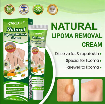 🔥 Limited Deal - 60% OFF! 🔥 Cvreoz® Natural Lipoma Removal Cream