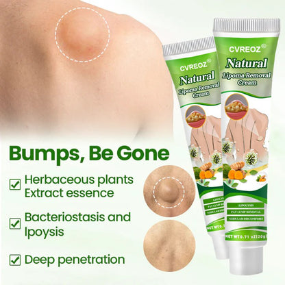 🔥 Limited Deal - 60% OFF! 🔥 Cvreoz® Natural Lipoma Removal Cream