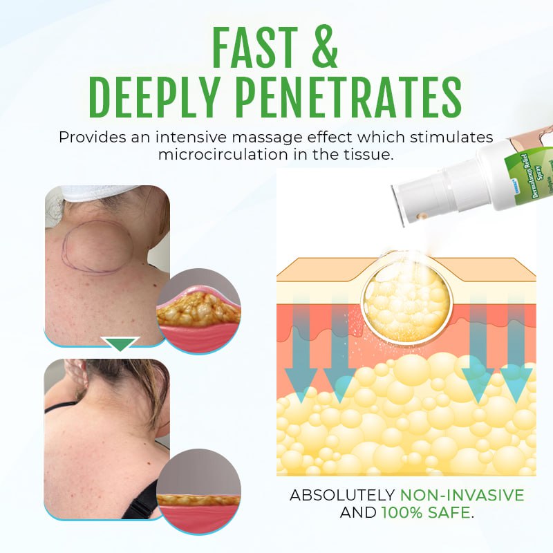 Cvreoz® DermaLump Relief Spray 31 Cvreoz® DermaLump Relief Spray