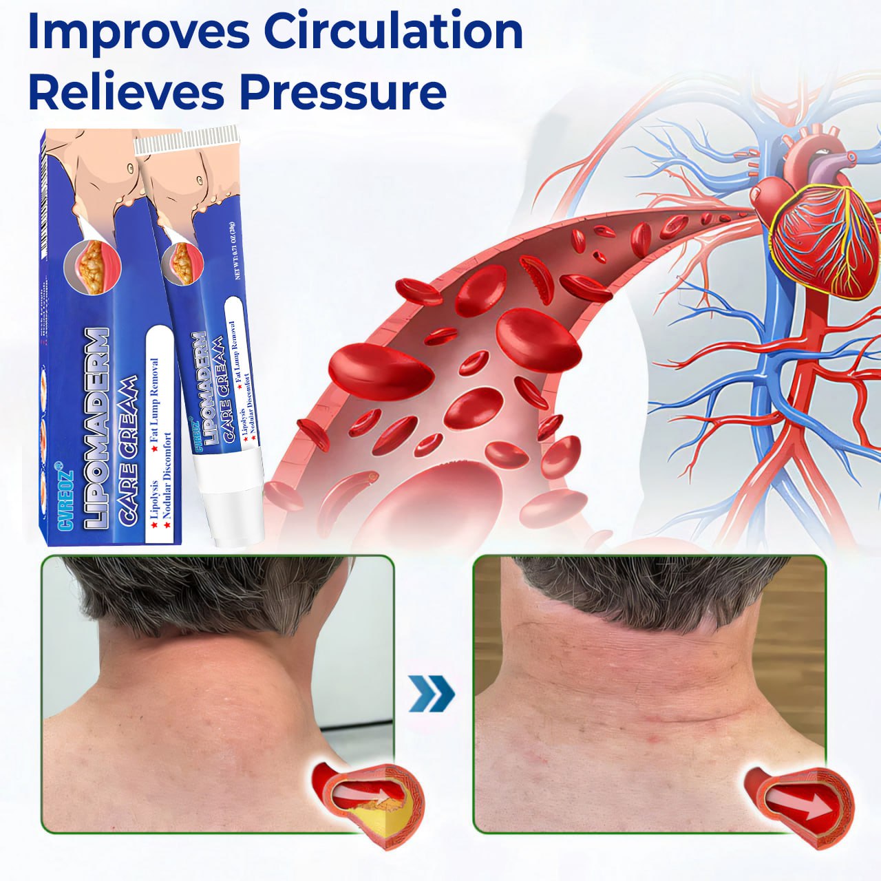 Cvreoz® LipomaDerm Care Cream ⏰LIMITED OFFER 60% OFF🔥