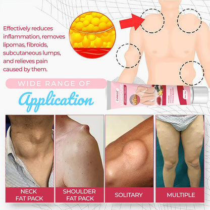 🩷 CVREOZ® LumpCure Lipoma Cream 🔥 SUMMER SALE 60%